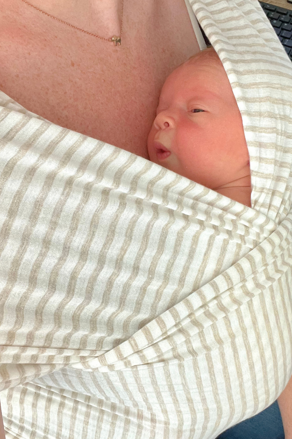 Homemade Gripe Water for Colic - Home Remedies